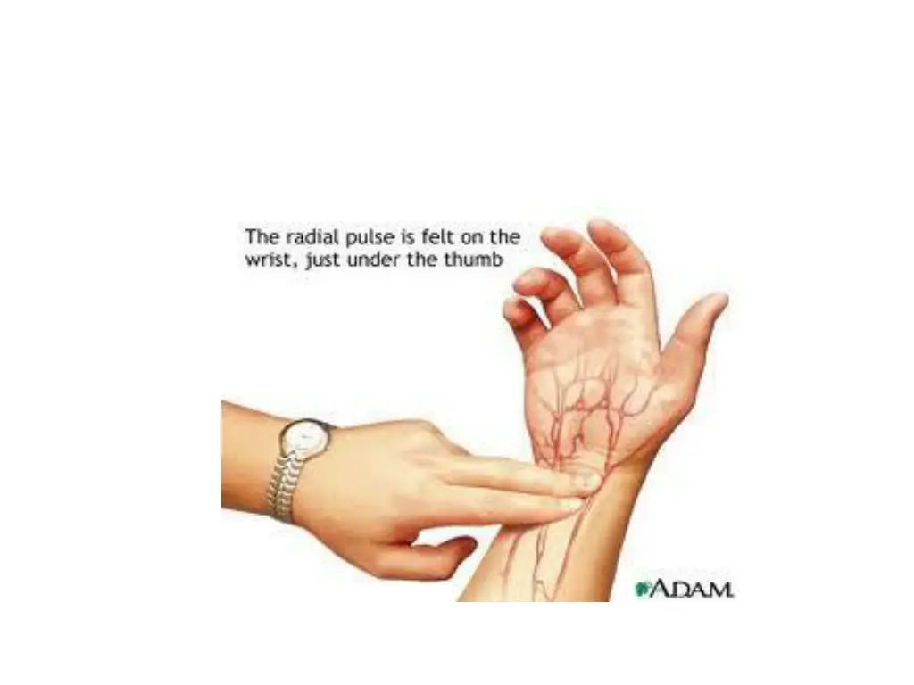slide8
