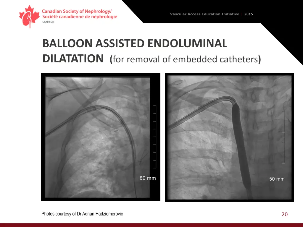 vascular access education initiative 2015 19