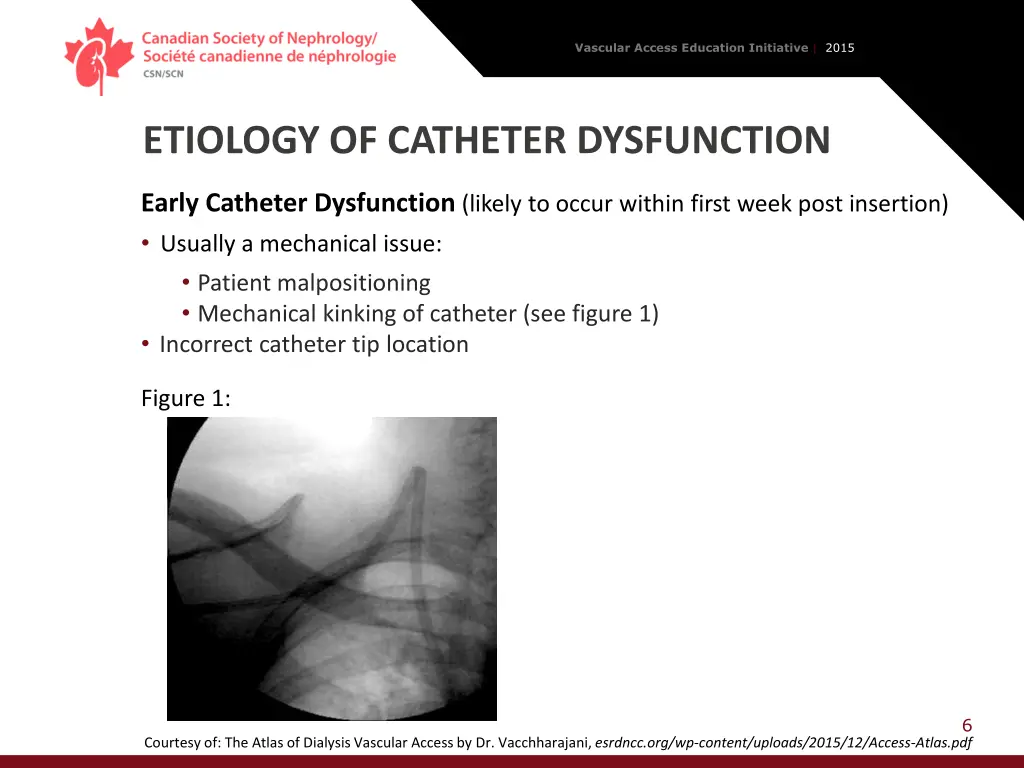 vascular access education initiative 2015 5