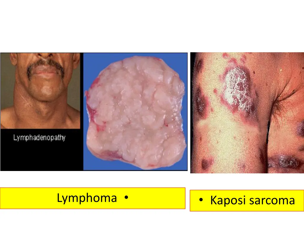slide18