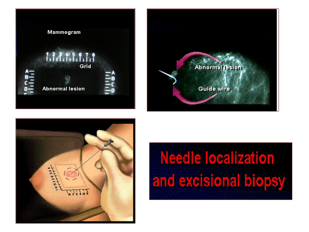slide34