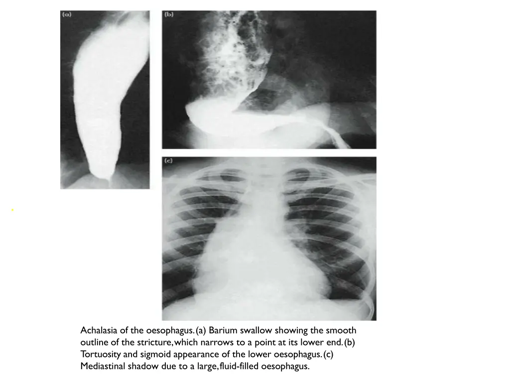 slide27