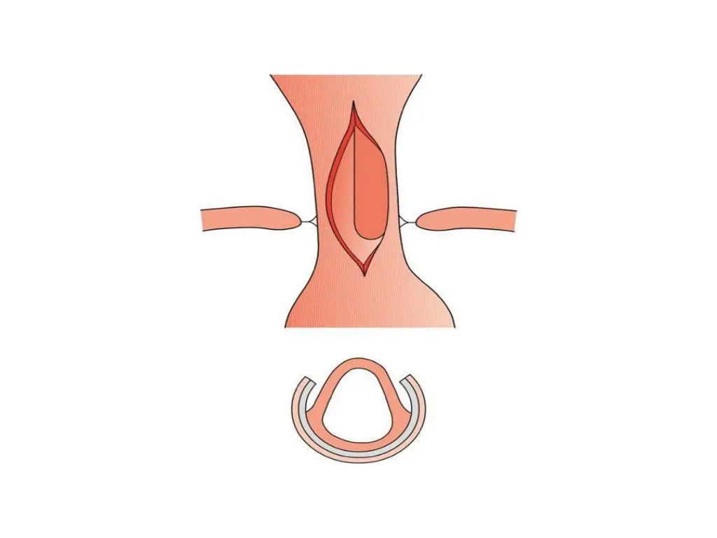 slide30
