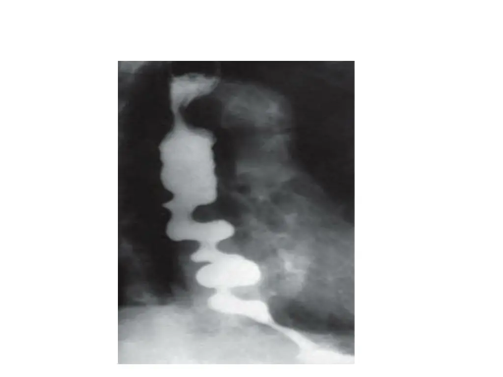 slide34