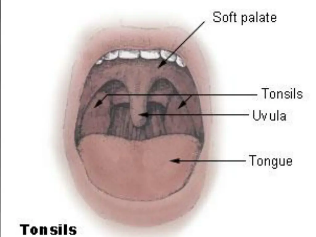 slide13
