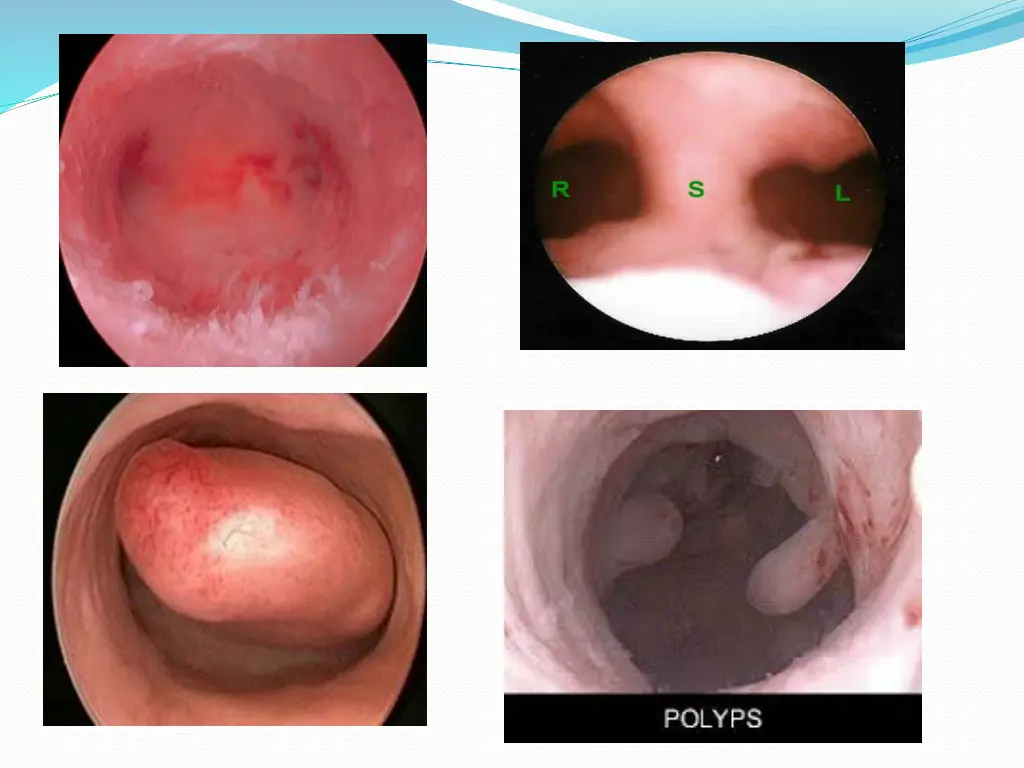 slide31