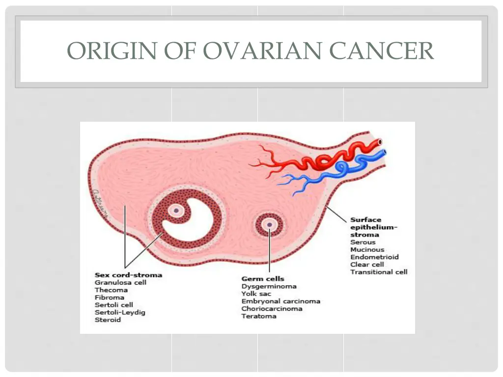 origin of ovarian cancer