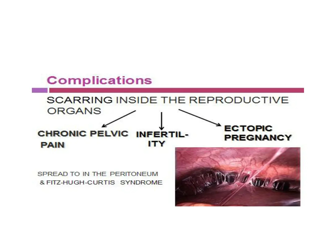 slide13