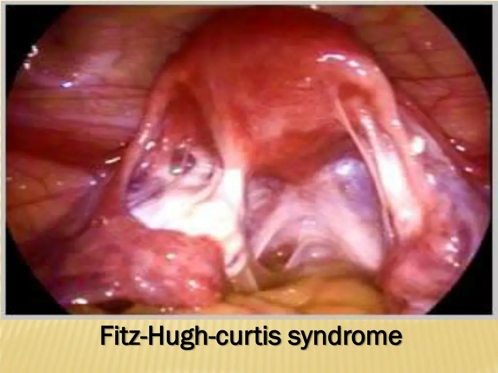 fitz fitz hugh hugh curtis