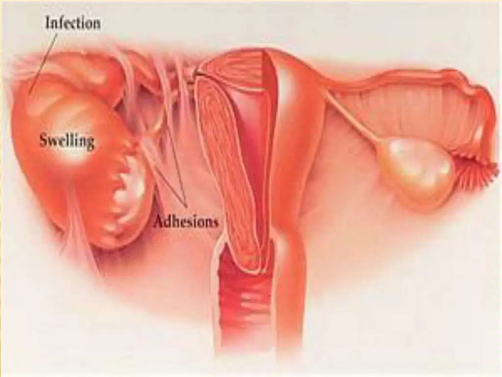 slide28