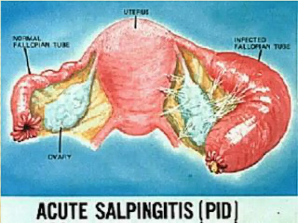 slide30