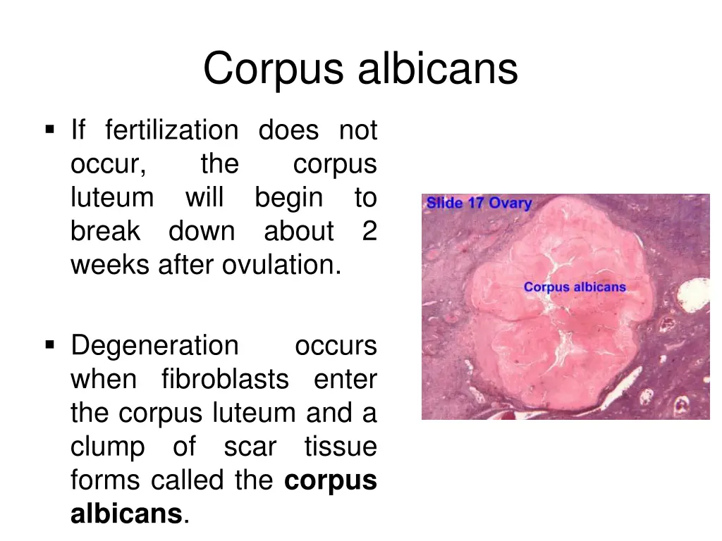 corpus albicans
