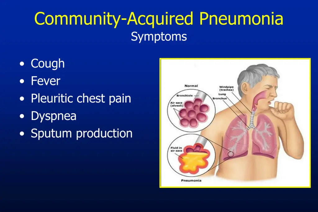community acquired pneumonia symptoms