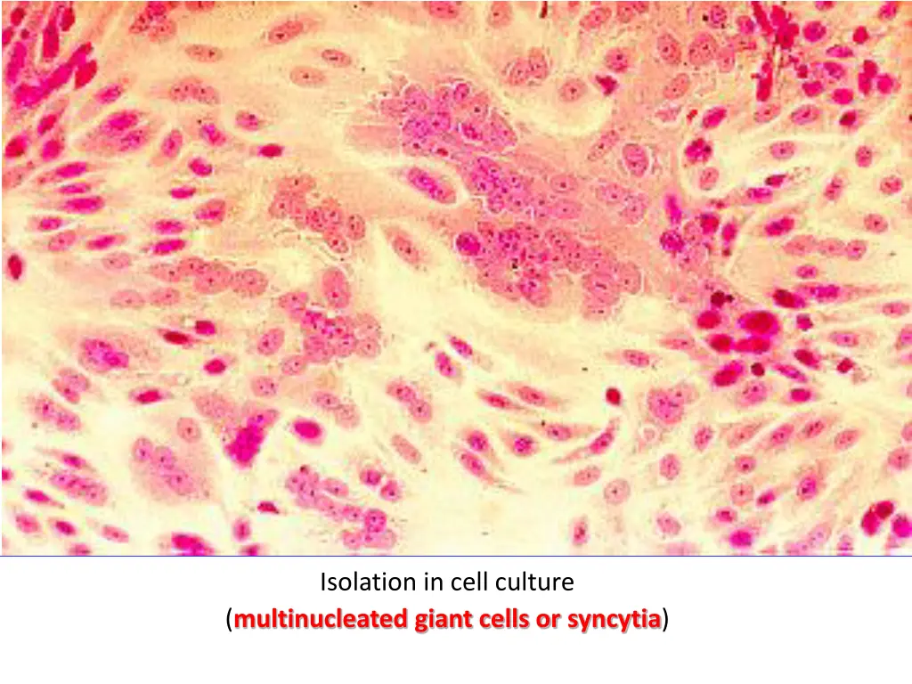 isolation in cell culture multinucleated giant