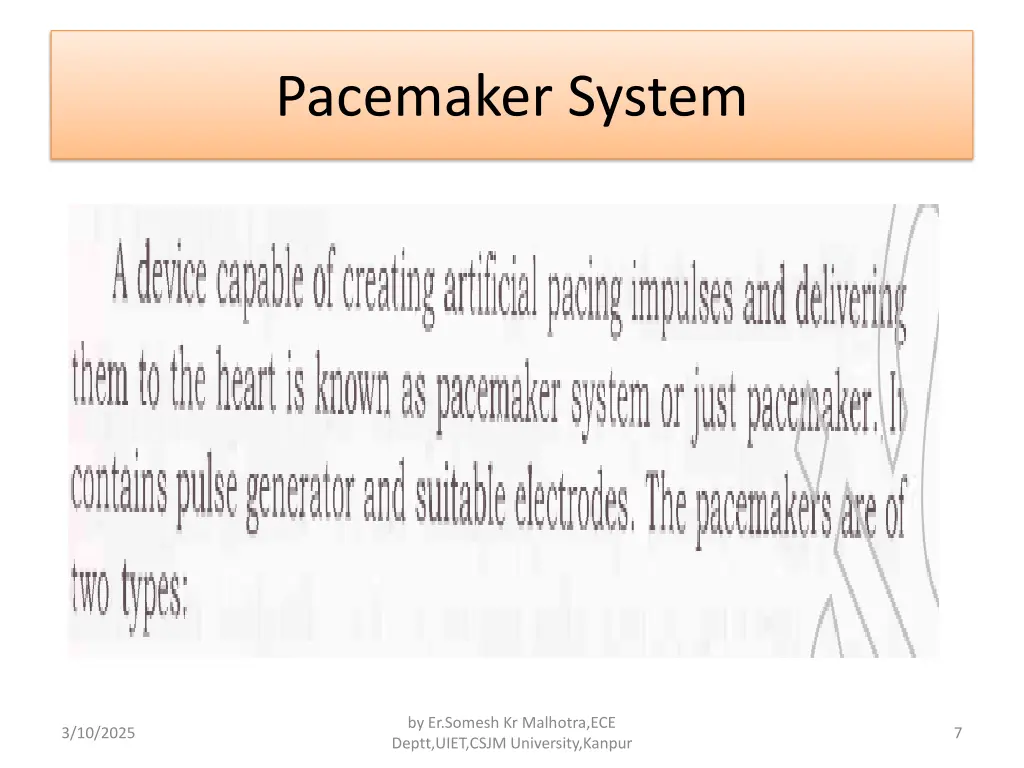pacemaker system