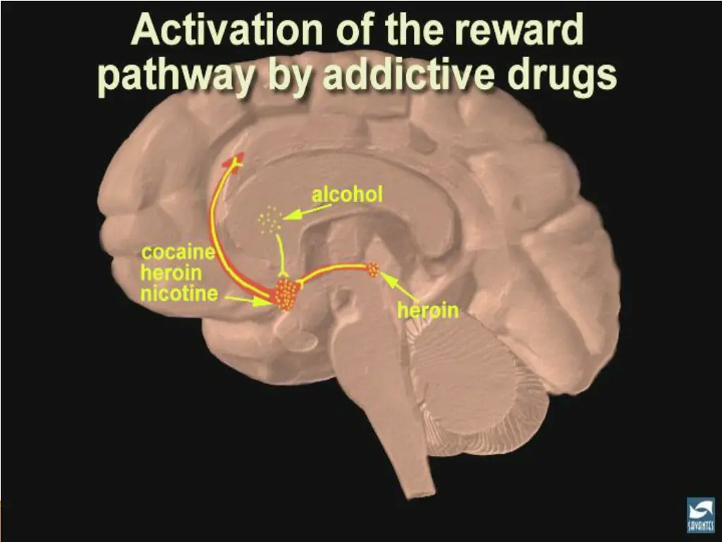 slide31