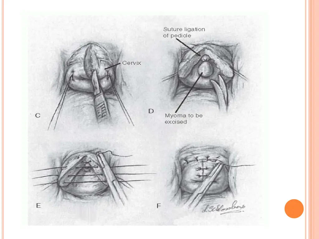 slide38