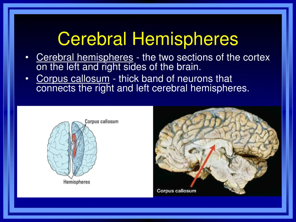 cerebral hemispheres cerebral hemispheres