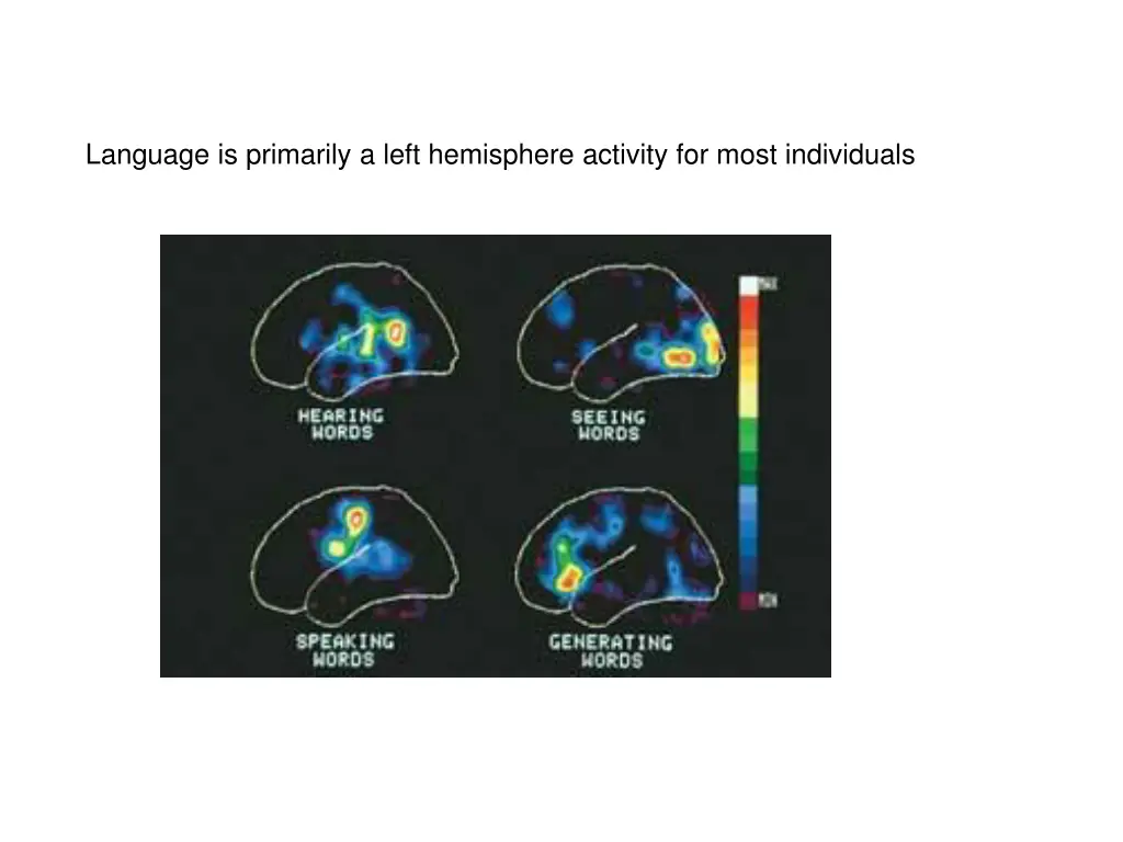 language is primarily a left hemisphere activity