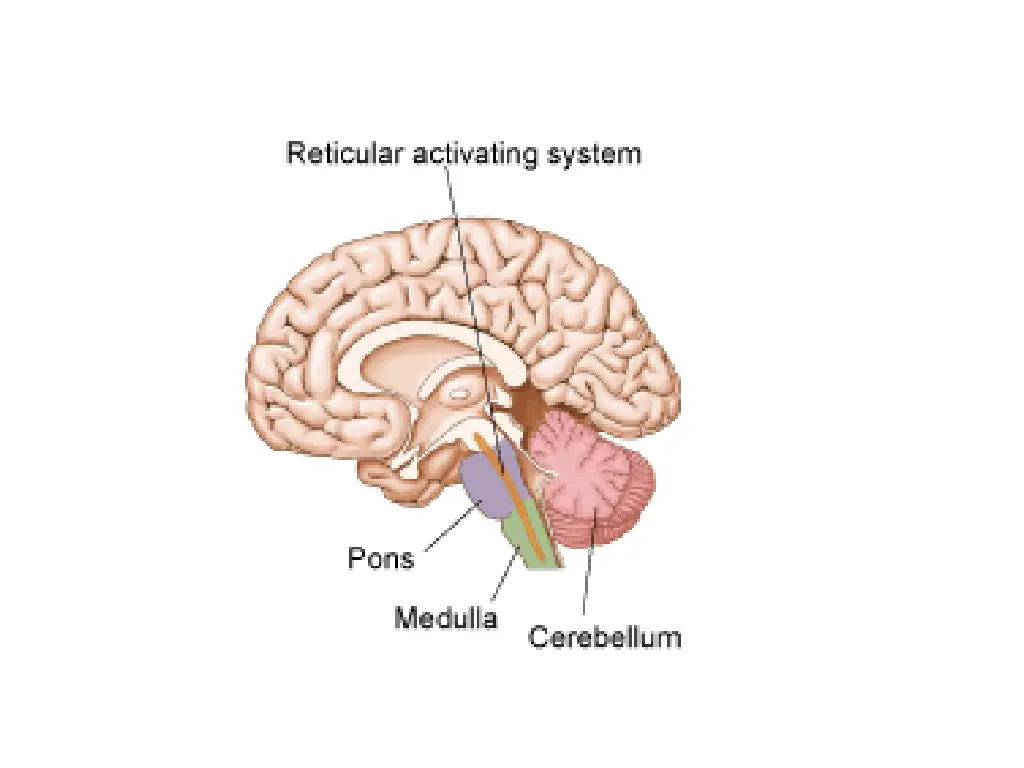 slide28