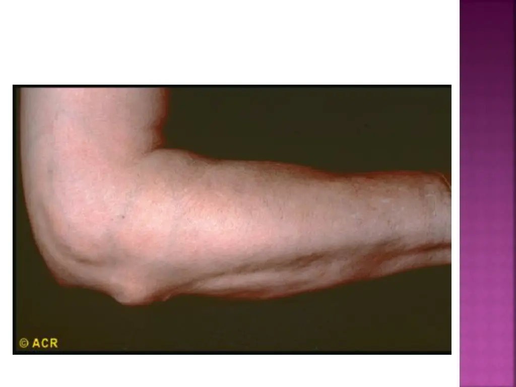 slide11