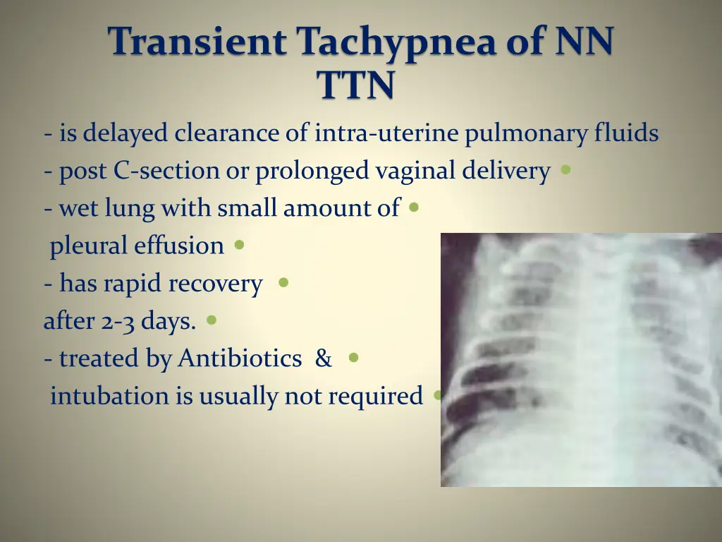transient tachypnea of nn ttn is delayed