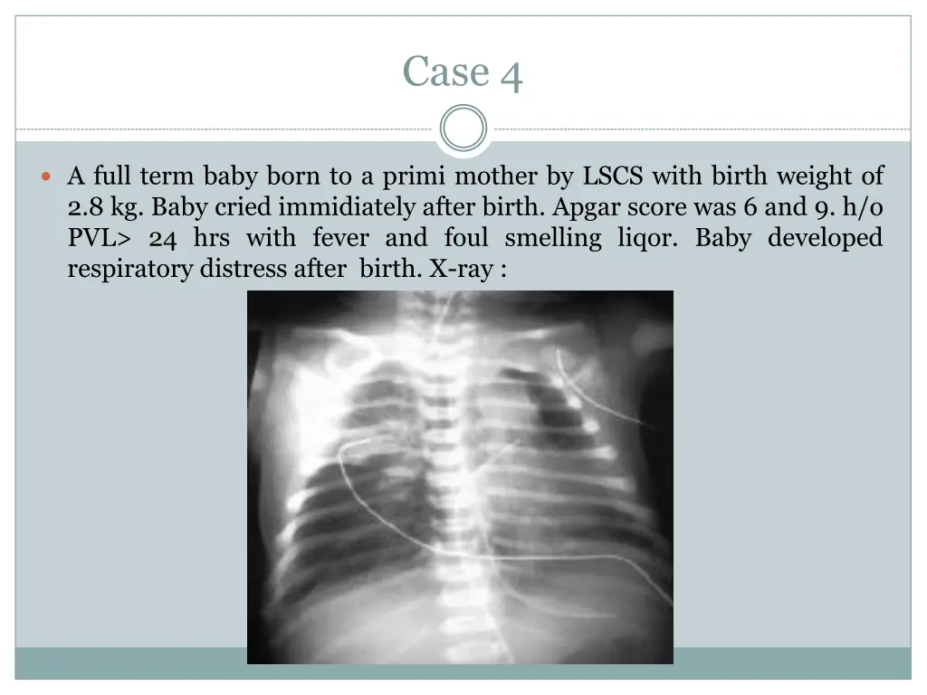 case 4