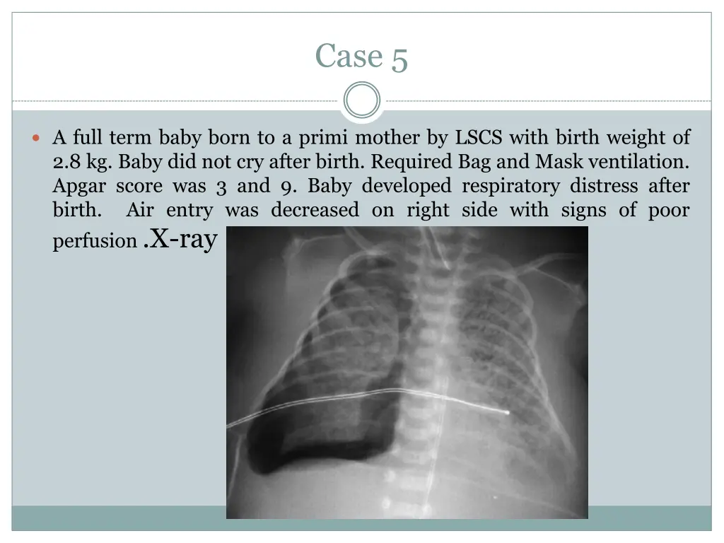 case 5