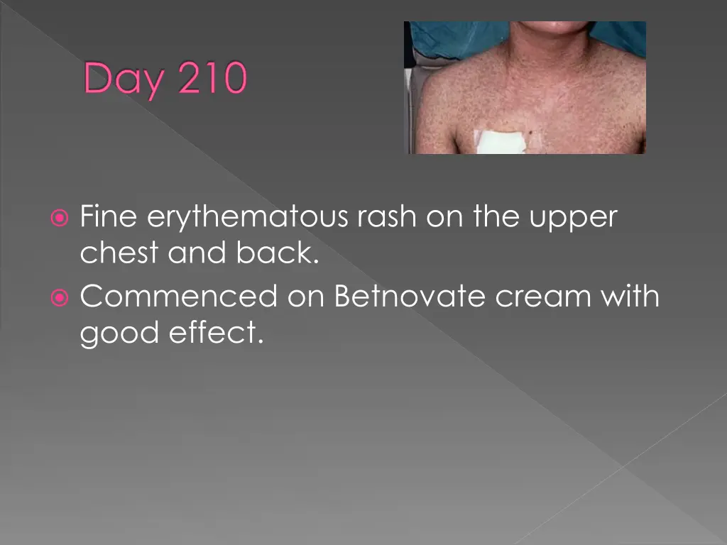 day 210