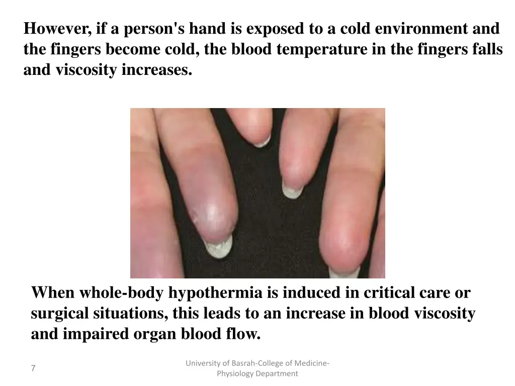 however if a person s hand is exposed to a cold