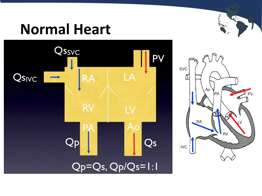 normal heart