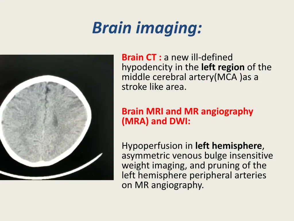 brain imaging