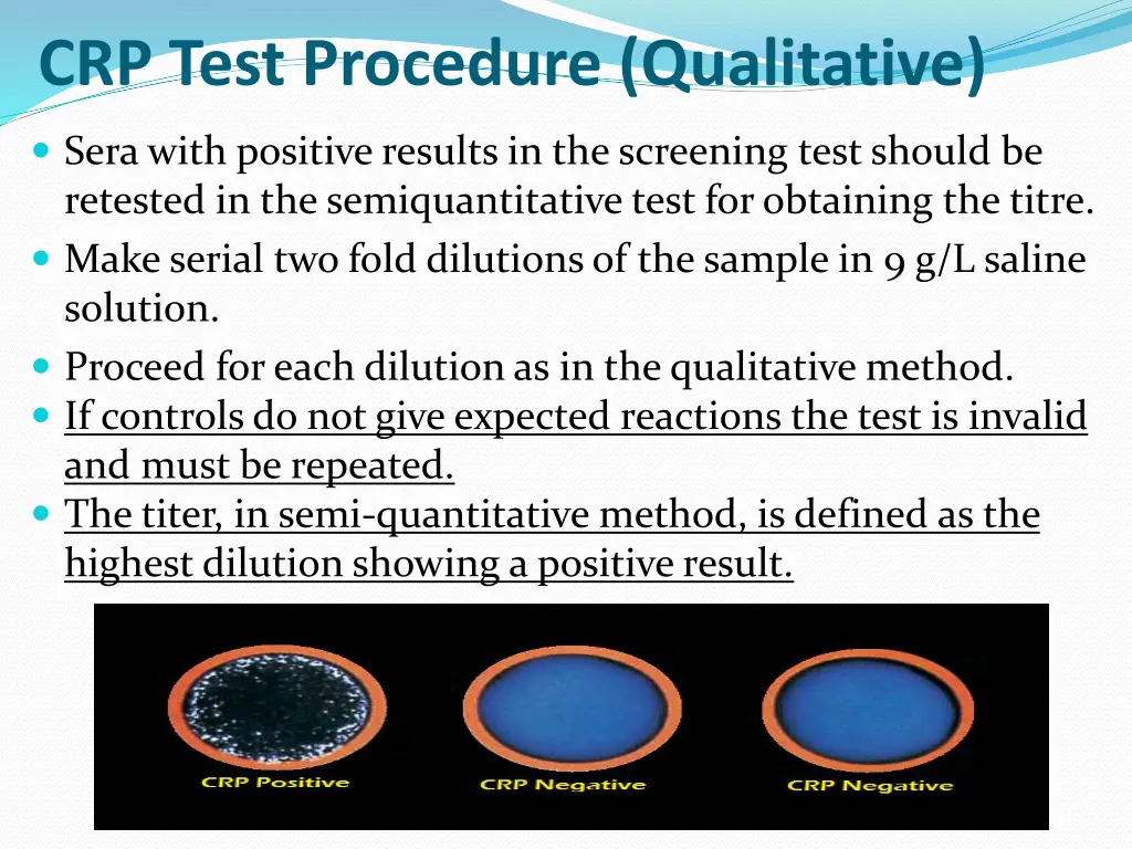 crp test procedure qualitative