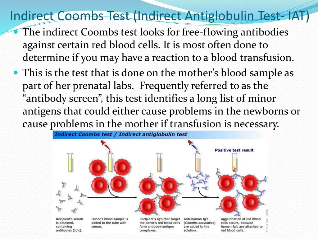indirect coombs test indirect antiglobulin test