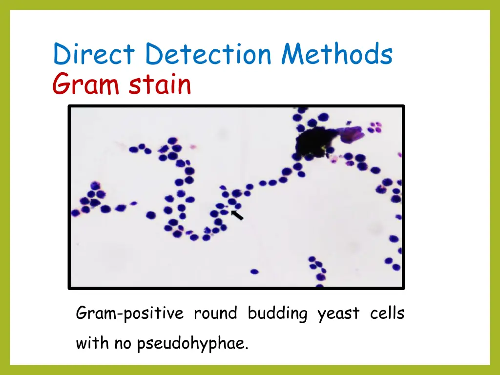 direct detection methods gram stain