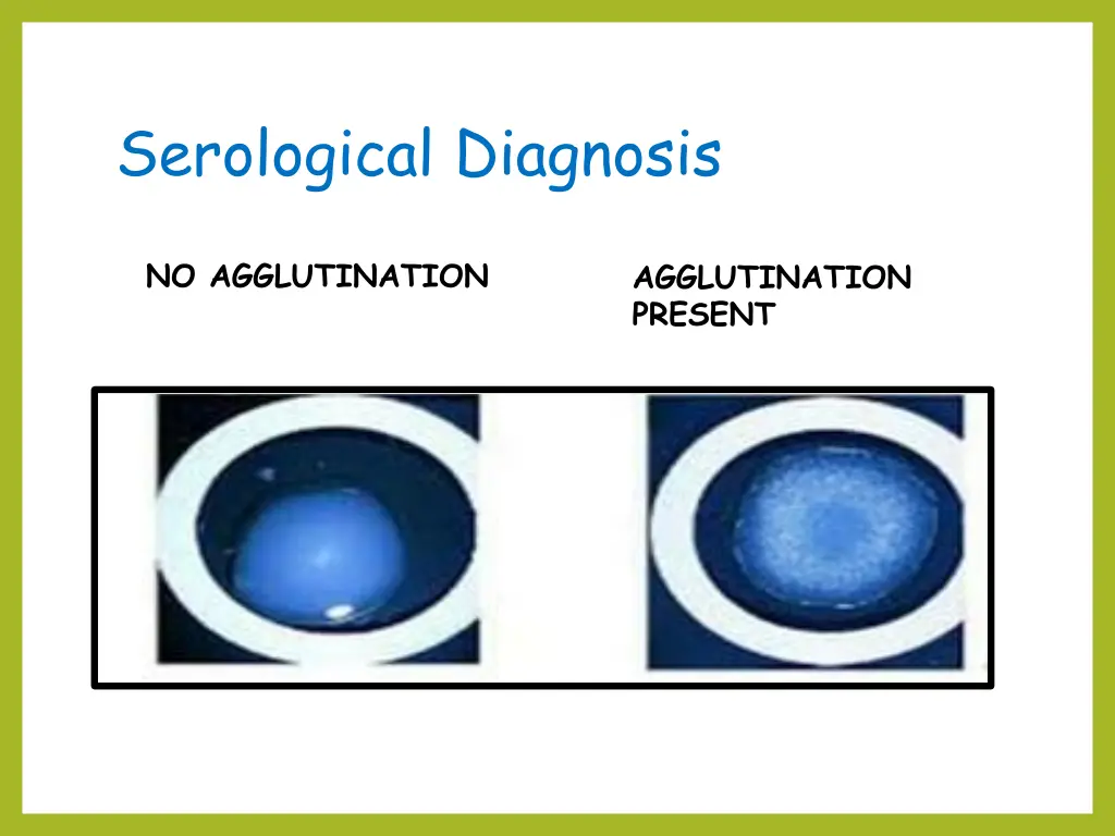 serological diagnosis