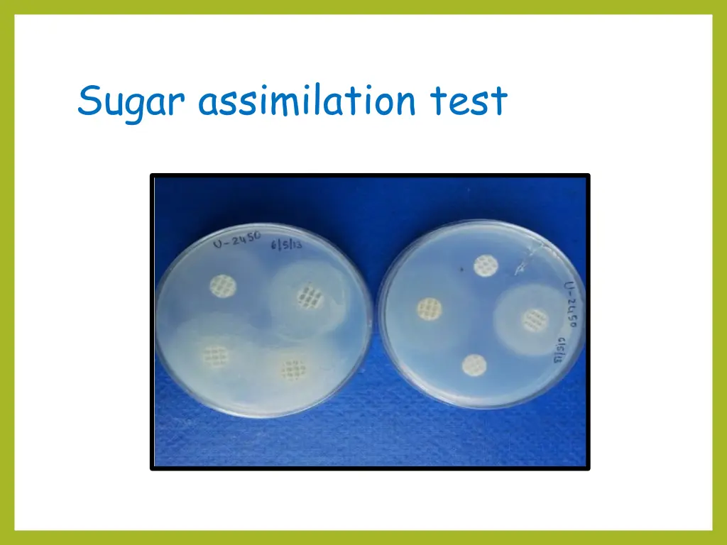 sugar assimilation test 1
