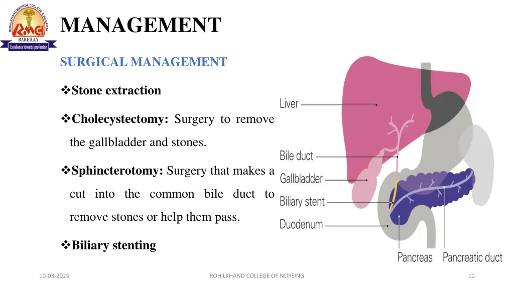 management
