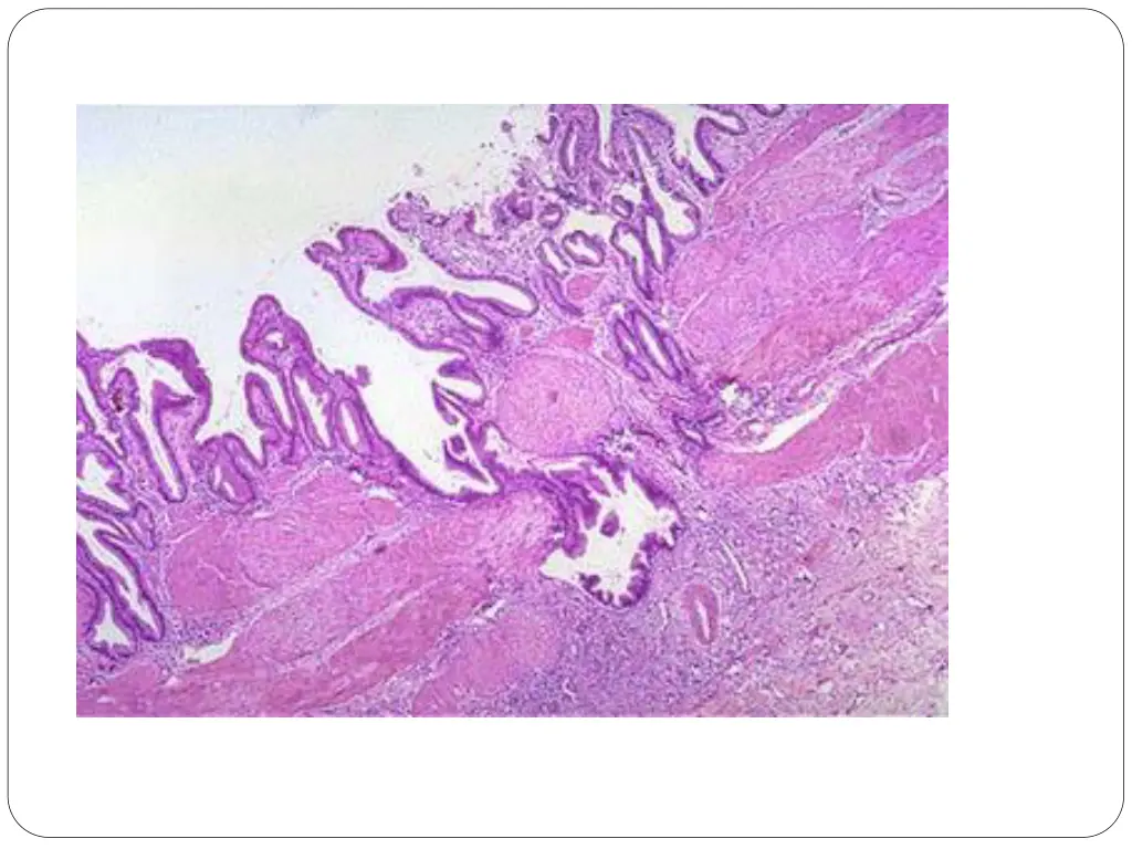 slide32