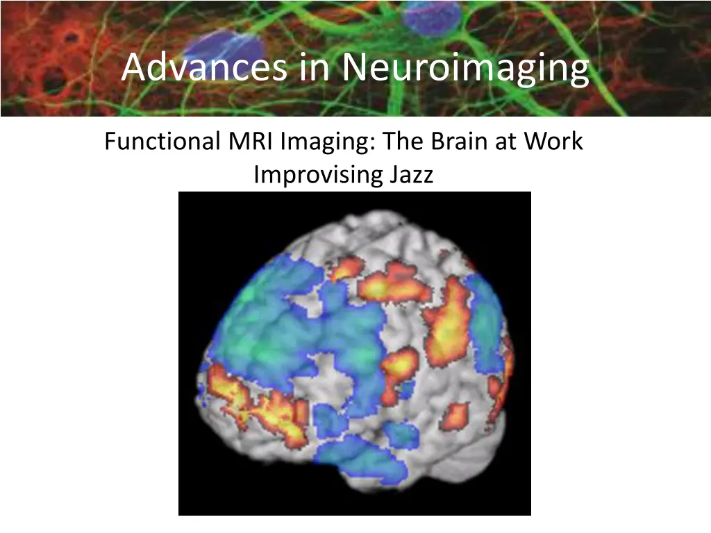advances in neuroimaging