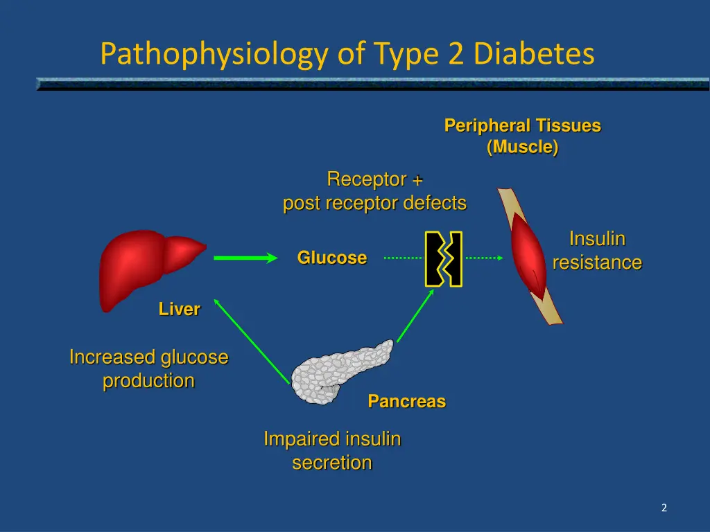 pathophysiology of type 2 diabetes