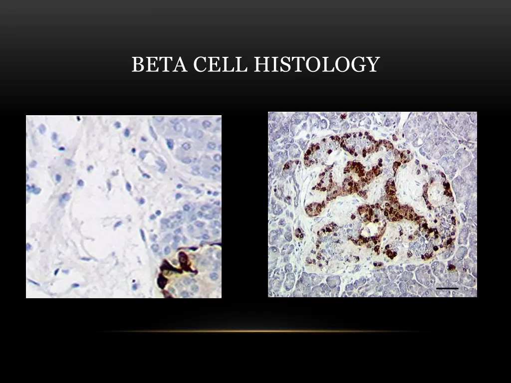 beta cell histology