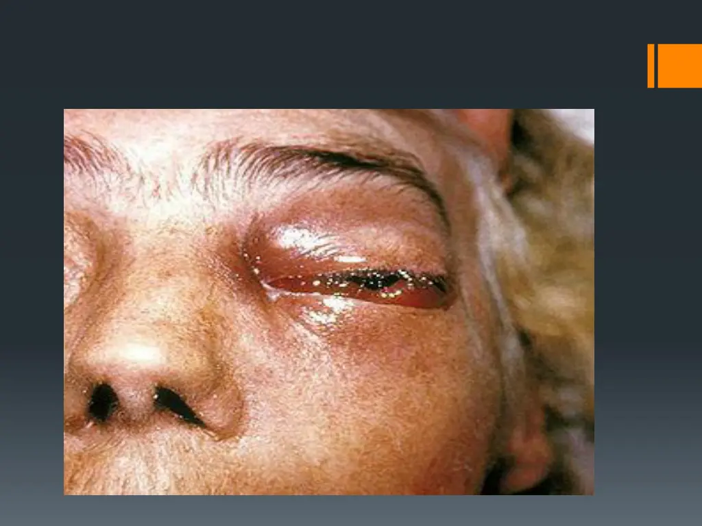 slide13