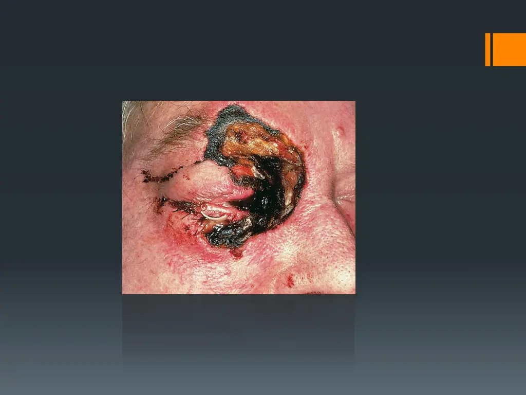 slide14