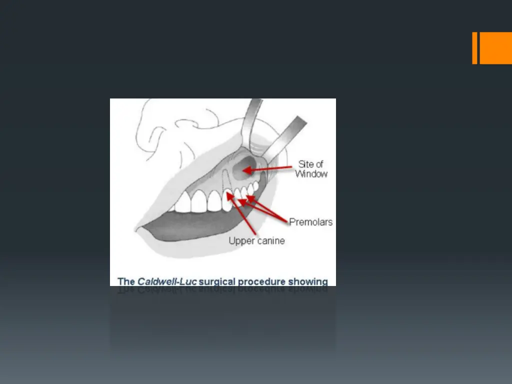 slide18