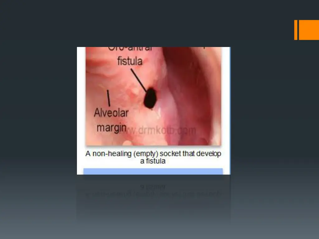 slide21