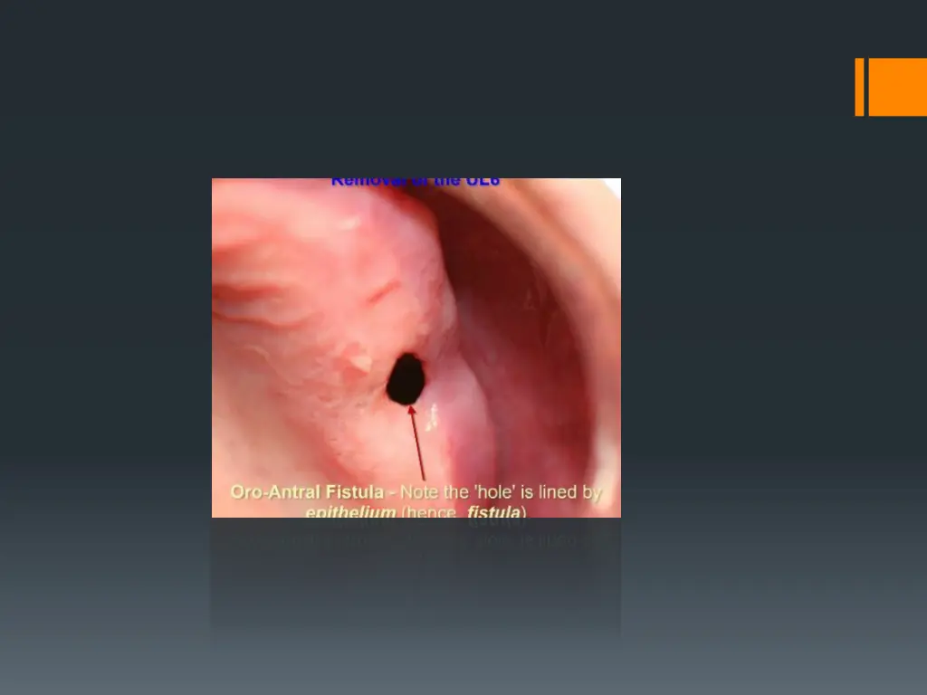 slide22