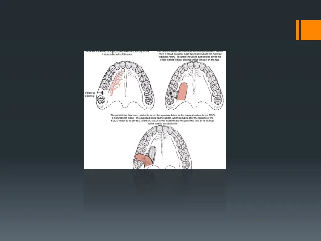 slide24