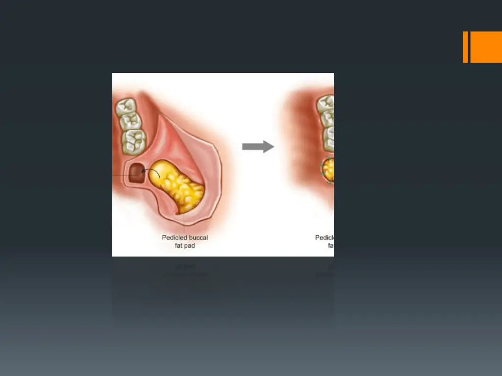 slide25