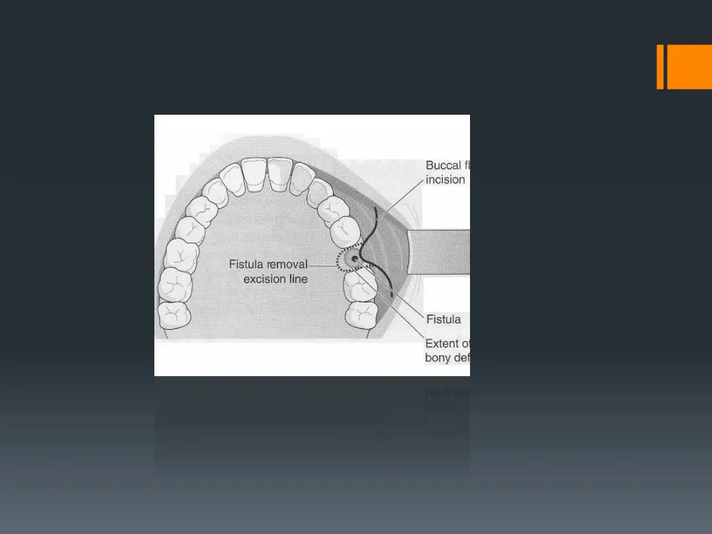 slide26